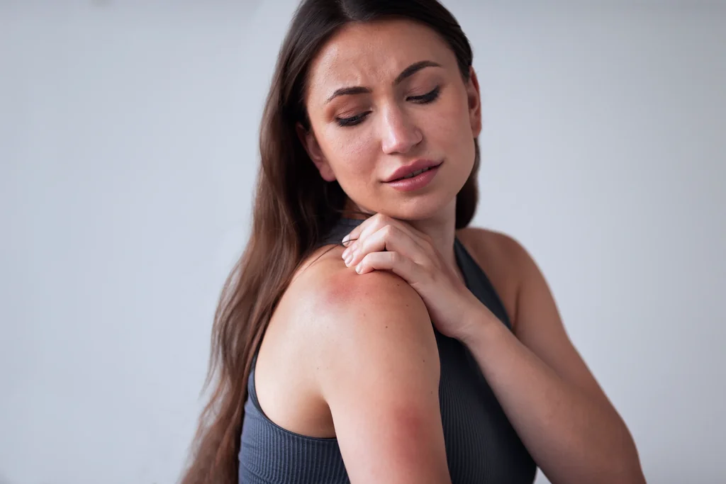 Eczema at AgeRejuvenation in Tampa, FL