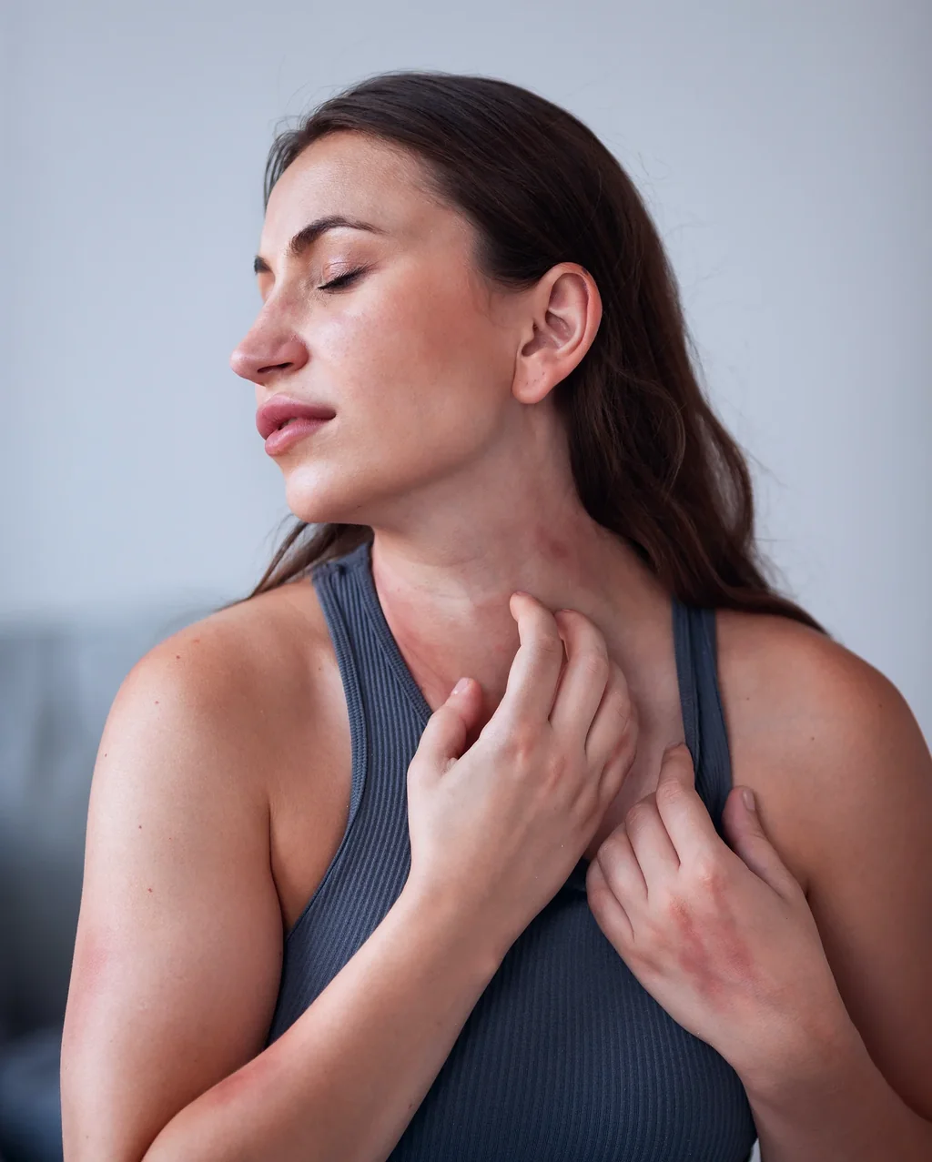 Psoriasis at AgeRejuvenation in Tampa, FL