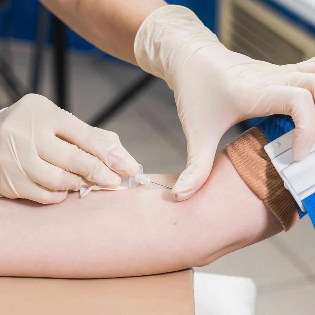 Heavy Metal Toxicity Testing treatment at AgeRejuvenation in Tampa, FL