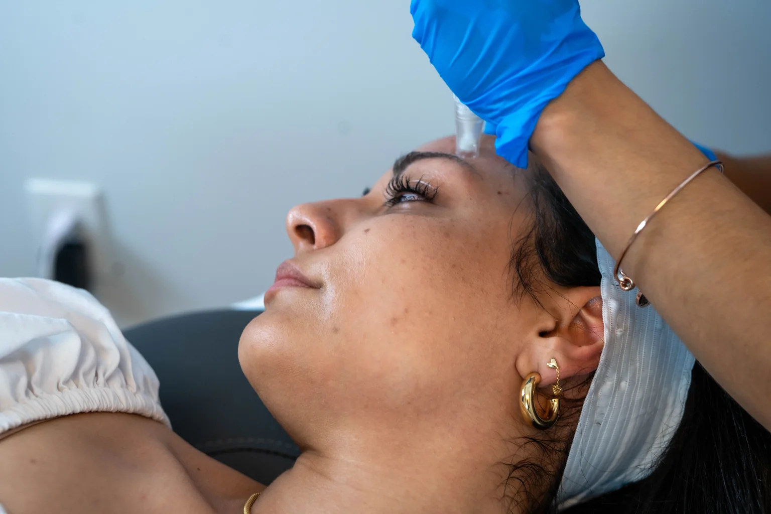 Microneedling at AgeRejuvenation in Tampa, FL